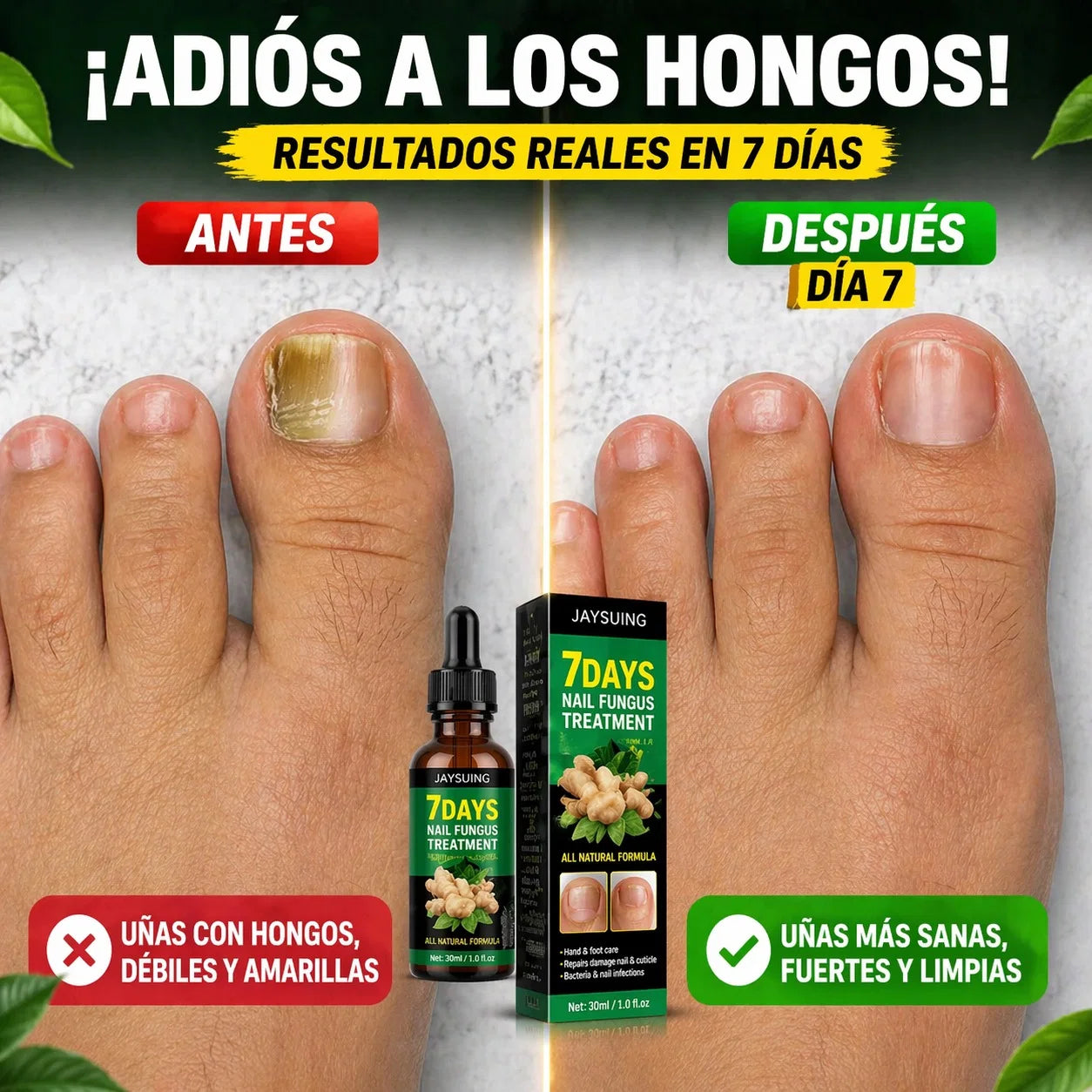 7 Days Nail Fungus Treatment con extracto de jengibre